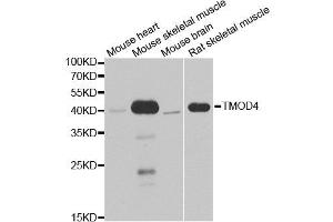 Western blot analysis of extracts of various cell lines, using TMOD4 antibody. (Tropomodulin 4 antibody)