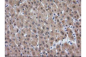 Image no. 3 for anti-Alcohol Dehydrogenase 1B (Class I), beta Polypeptide (ADH1B) antibody (ABIN1496479) (ADH1B antibody)