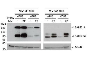 Western blot analysis of 884 SARS-CoV-2 S protein in cell lysates of Vero cells infected with the rMVs expressing SF-dER or S2-dER from either ATU2 or ATU3, with or without the 2P mutation. (SARS-CoV Spike antibody  (AA 1124-1140))