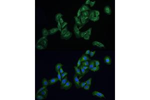Immunofluorescence analysis of U2OS cells using AGTRAP Rabbit pAb (ABIN6130822, ABIN6136657, ABIN6136658 and ABIN6215773) at dilution of 1:100 (40x lens). (AGTRAP antibody  (AA 93-152))