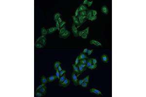 Immunofluorescence analysis of U2OS cells using AGTRAP Rabbit pAb (ABIN6130822, ABIN6136657, ABIN6136658 and ABIN6215773) at dilution of 1:100 (40x lens). (AGTRAP antibody  (AA 93-152))