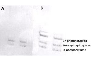 MYL6 (phospho S19/20) polyclonal antibody  was used at a 1 : 1000 dilution to detect myosin light chain by Western blot on NIH/3T3 cell lysates. (MYL6 antibody  (pSer19, pSer20))
