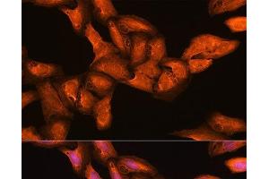 Immunofluorescence analysis of U2OS cells using BGLAP Polyclonal Antibody at dilution of 1:100. (Osteocalcin antibody)