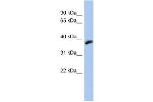 WB Suggested Anti-CYB5RL Antibody Titration: 0. (CYB5RL antibody  (N-Term))