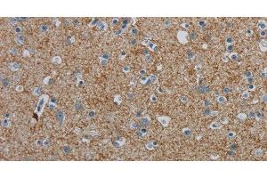 Immunohistochemistry of paraffin-embedded Human brain tissue using PGLYRP1 Polyclonal Antibody at dilution 1:40 (PGLYRP1 antibody)