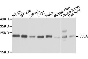 Western blot analysis of extracts of various cell lines, using IL36A antibody. (IL36A/IL1F6 antibody)