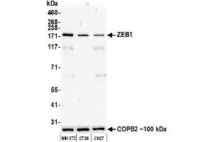 Western Blotting (WB) image for anti-Zinc Finger E-Box Binding Homeobox 1 (ZEB1) (AA 750-800) antibody (ABIN7455173)