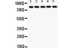 Western Blotting (WB) image for anti-SRY (Sex Determining Region Y)-Box 5 (SOX5) (AA 495-528), (C-Term) antibody (ABIN3043348) (SOX5 antibody  (C-Term))