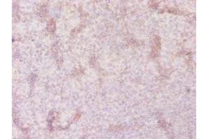 Immunohistochemistry of paraffin-embedded human tonsil tissue using ABIN7170251 at dilution of 1:20 (SLC41A2 antibody  (AA 1-162))