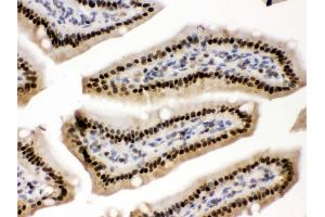 Anti- AMPK beta 2 Picoband antibody, IHC(P) IHC(P): Mouse Intestine Tissue (PRKAB2 antibody  (N-Term))