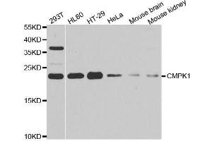 Western blot analysis of extracts of various cell lines, using CMPK1 antibody. (Cytidine Monophosphate (UMP-CMP) Kinase 1, Cytosolic (CMPK1) (AA 69-228) antibody)