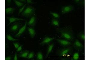 Image no. 2 for anti-Mitogen-Activated Protein Kinase-Activated Protein Kinase 2 (MAPKAPK2) (AA 302-401) antibody (ABIN598601) (MAPKAP Kinase 2 antibody  (AA 302-401))