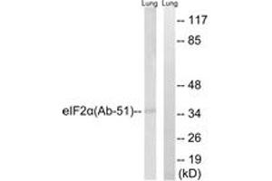 Western blot analysis of extracts from rat lung, using eIF2 alpha (Ab-51) Antibody.