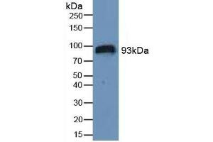 Detection of HIF1a in Human Serum using Polyclonal Antibody to Hypoxia Inducible Factor 1 Alpha (HIF1a) (HIF1A antibody  (AA 575-826))
