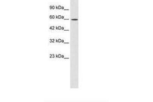 Image no. 2 for anti-Zinc Finger Protein 12 (ZNF12) (AA 73-122) antibody (ABIN202669) (ZNF12 antibody  (AA 73-122))