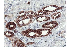 Immunohistochemical staining of paraffin-embedded Human Kidney tissue using anti-PFKP mouse monoclonal antibody. (PFKP antibody)