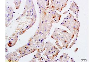 Formalin-fixed and paraffin embedded mouse heart tissue labeled with Anti-Desmin Polyclonal Antibody, Unconjugated  at 1:200, followed by conjugation to the secondary antibody and DAB staining (Desmin antibody  (AA 261-360))