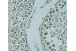 Immunohistochemistry of paraffin-embedded Rat testis using PRDM2 Polyclonal Antibody at dilution of 1:100 (40x lens). (PRDM2 antibody)