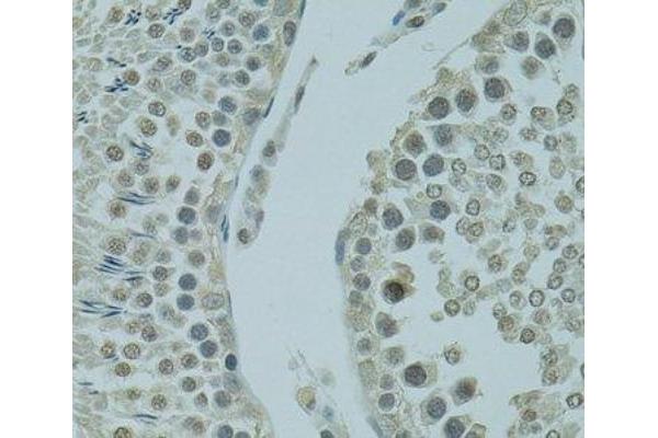 PRDM2 antibody