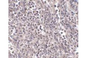 Immunohistochemistry of EBI3 in human spleen tissue with EBI3 antibody at 2. (EBI3 antibody  (Center))