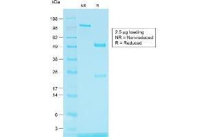 SDS-PAGE Analysis of Purified TYRP1 Rabbit Recombinant Monoclonal Antibody (TYRP1/1564R) (Tyrosinase-Related Protein 1 antibody)