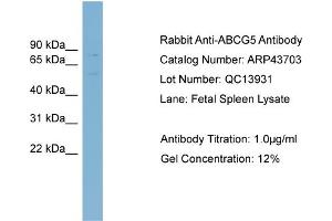 WB Suggested Anti-ABCG5 Antibody Titration:  0. (ABCG5 antibody  (Middle Region))
