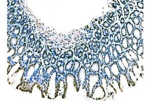 IHC analysis of KLF4 using anti-KLF4 antibody (ABIN7599343).