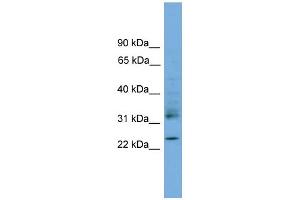 WB Suggested Anti-RHOJ Antibody Titration: 0.