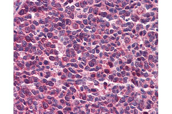 DENND1B antibody  (AA 144-193)