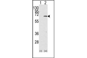 Image no. 1 for anti-Protein Inhibitor of Activated STAT, 1 (PIAS1) (C-Term) antibody (ABIN356763) (PIAS1 antibody  (C-Term))