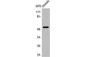 Western Blot analysis of Jurkat cells using PRP19 Polyclonal Antibody (PRP19 antibody  (Internal Region))