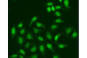 Immunofluorescence analysis of A549 cell using CETN2 antibody. (CETN2 antibody)