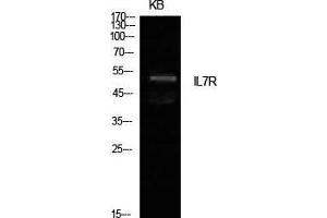 Western Blot (WB) analysis of KB cells using IL-7R Polyclonal Antibody. (IL7R antibody  (Internal Region))