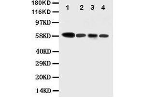 Anti-Caspase-10 antibody, Western blotting Lane 1: COLO320 Cell Lysate Lane 2: HELA Cell Lysate Lane 3: SW620 Cell Lysate Lane 4: RAJI Cell Lysate (Caspase 10 antibody  (N-Term))