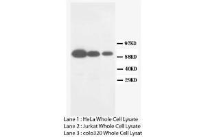 Image no. 2 for anti-Matrix Metallopeptidase 16 (Membrane-inserted) (MMP16) (C-Term) antibody (ABIN1493062) (MMP16 antibody  (C-Term))