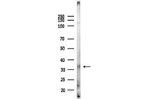 anti-Olfactory Receptor, Family 5, Subfamily T, Member 3 (OR5T3) antibody