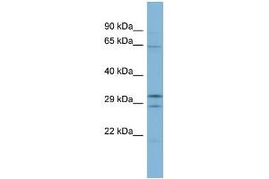 WB Suggested Anti-FAM131C Antibody Titration: 0. (FAM131C antibody  (Middle Region))