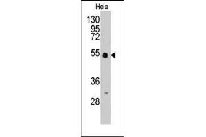 Western blot analysis of anti-BBS4 Pab in Hela cell line lysates (35ug/lane). (BBS4 antibody  (Middle Region))