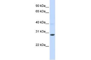 WB Suggested Anti-PGAM2 Antibody Titration:  0.