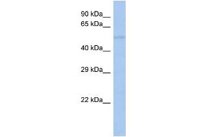 Western Blotting (WB) image for anti-Transforming Growth Factor beta 1 Induced Transcript 1 (TGFB1I1) (Middle Region) antibody (ABIN2777947)