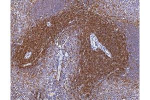 IHC analysis of Cd2 using anti-Cd2 antibody (ABIN7601386). (CD2 antibody  (AA 34-330))