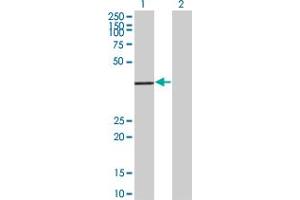 Western Blot analysis of ALS2CR7 expression in transfected 293T cell line by ALS2CR7 polyclonal antibody (A01). (Cyclin-Dependent Kinase 15 (ALS2CR7) (AA 242-347) antibody)