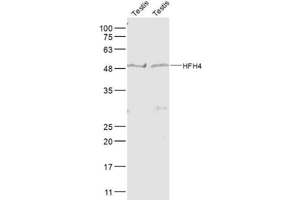 FOXJ1 Antikörper  (AA 161-260)