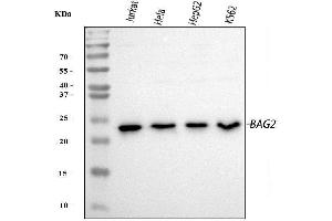 Western blot analysis of BAG2 using anti-BAG2 antibody (ABIN3043508). (BAG2 antibody  (AA 1-211))