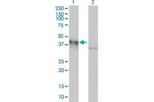 Western Blot analysis of DCX expression in transfected 293T cell line by DCX monoclonal antibody (M01), clone 1G12. (Doublecortin antibody  (AA 1-360))