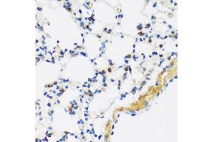 Immunohistochemistry (IHC) image for anti-Apolipoprotein B mRNA Editing Enzyme, Catalytic Polypeptide-Like 3F (APOBEC3F) (AA 1-65) antibody (ABIN3016159)