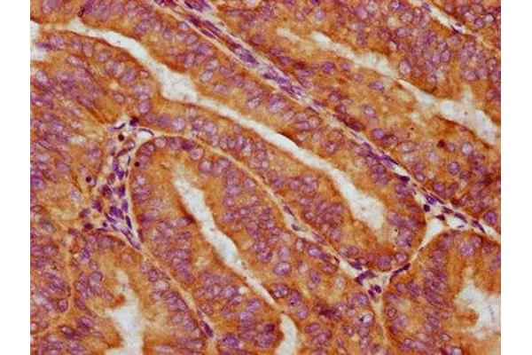 Cytokeratin 2 antibody  (AA 173-283)