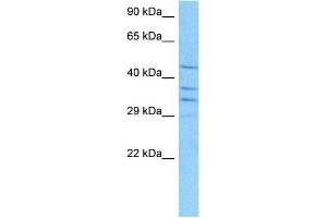 Host:  Mouse  Target Name:  RUVBL2  Sample Tissue:  Mouse Kidney  Antibody Dilution:  1ug/ml (RUVBL2 antibody  (N-Term))