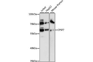 Western blot analysis of extracts of various cell lines, using CPSF7 antibody (ABIN6131022, ABIN6140675, ABIN6140676 and ABIN6218037) at 1:3000 dilution. (CPSF7 antibody  (AA 50-240))