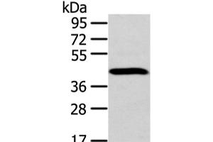 Western blot analysis of Human fetal brain tissue using DCAF7 Polyclonal Antibody at dilution of 1:300 (DCAF7 antibody)